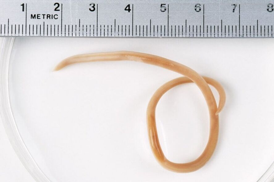 pinworm од човечкото тело
