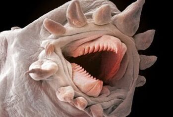 какви црви можат да живеат во човечкото тело